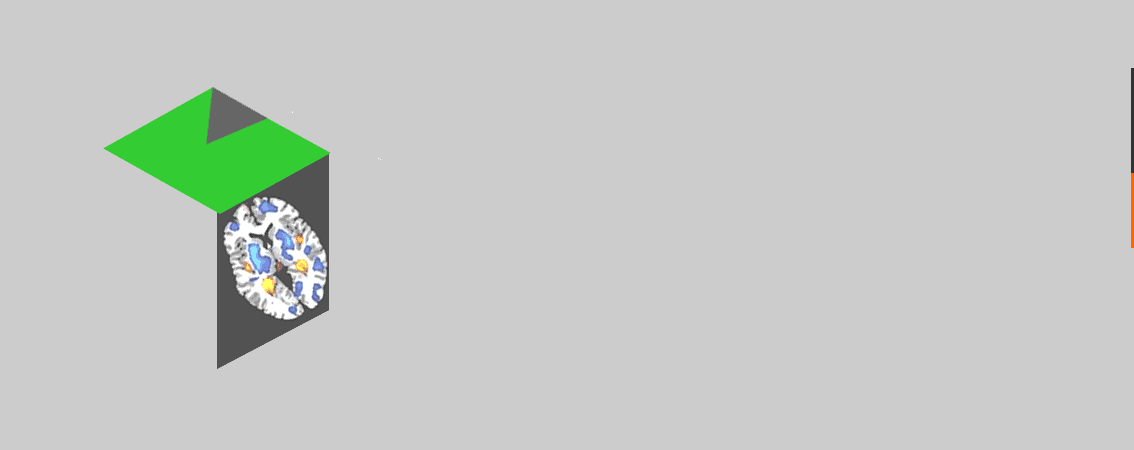 Skip Appointment to connect Neurology Specialist